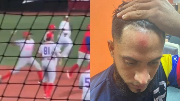 Este lanzador le pegó un pelotazo en el rostro a un jugador en plena trifulca